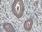 TUBAL3 Antibody in Immunohistochemistry (Paraffin) (IHC (P))
