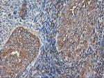 TUBAL3 Antibody in Immunohistochemistry (Paraffin) (IHC (P))