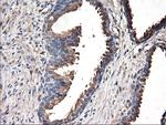 TUBAL3 Antibody in Immunohistochemistry (Paraffin) (IHC (P))