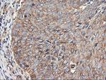 TUBAL3 Antibody in Immunohistochemistry (Paraffin) (IHC (P))