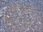 TUBAL3 Antibody in Immunohistochemistry (Paraffin) (IHC (P))