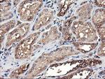 TUBAL3 Antibody in Immunohistochemistry (Paraffin) (IHC (P))