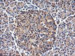 TUBAL3 Antibody in Immunohistochemistry (Paraffin) (IHC (P))