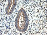 TUBAL3 Antibody in Immunohistochemistry (Paraffin) (IHC (P))