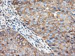 TUBAL3 Antibody in Immunohistochemistry (Paraffin) (IHC (P))