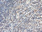 TUBAL3 Antibody in Immunohistochemistry (Paraffin) (IHC (P))