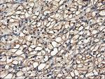 TUBAL3 Antibody in Immunohistochemistry (Paraffin) (IHC (P))