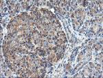 TUBAL3 Antibody in Immunohistochemistry (Paraffin) (IHC (P))