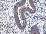 TUBAL3 Antibody in Immunohistochemistry (Paraffin) (IHC (P))