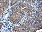 TUBAL3 Antibody in Immunohistochemistry (Paraffin) (IHC (P))