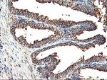 TUBAL3 Antibody in Immunohistochemistry (Paraffin) (IHC (P))