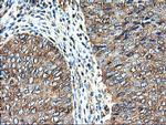 TUBAL3 Antibody in Immunohistochemistry (Paraffin) (IHC (P))