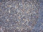 TUBAL3 Antibody in Immunohistochemistry (Paraffin) (IHC (P))