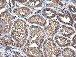 TUBAL3 Antibody in Immunohistochemistry (Paraffin) (IHC (P))