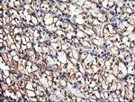 TUBAL3 Antibody in Immunohistochemistry (Paraffin) (IHC (P))