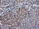 TUBAL3 Antibody in Immunohistochemistry (Paraffin) (IHC (P))