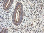 TUBAL3 Antibody in Immunohistochemistry (Paraffin) (IHC (P))