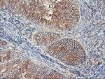 TUBAL3 Antibody in Immunohistochemistry (Paraffin) (IHC (P))