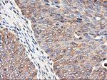 TUBAL3 Antibody in Immunohistochemistry (Paraffin) (IHC (P))