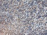 TUBAL3 Antibody in Immunohistochemistry (Paraffin) (IHC (P))