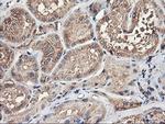 TUBAL3 Antibody in Immunohistochemistry (Paraffin) (IHC (P))