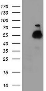 TUBAL3 Antibody in Western Blot (WB)