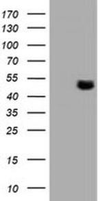 TUBAL3 Antibody in Western Blot (WB)