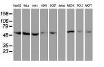 TUBAL3 Antibody in Western Blot (WB)