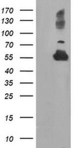 TUBAL3 Antibody in Western Blot (WB)