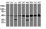 TUBAL3 Antibody in Western Blot (WB)
