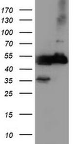 TUBAL3 Antibody in Western Blot (WB)