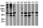 TUBAL3 Antibody in Western Blot (WB)