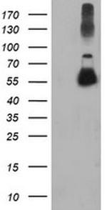 TUBAL3 Antibody in Western Blot (WB)