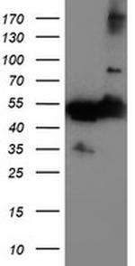 TUBAL3 Antibody in Western Blot (WB)