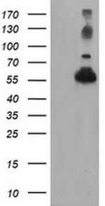 TUBAL3 Antibody in Western Blot (WB)