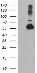 TUBAL3 Antibody in Western Blot (WB)