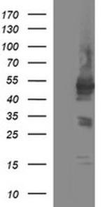 TUBB1 Antibody in Western Blot (WB)