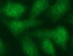 TUBB2A Antibody in Immunocytochemistry (ICC/IF)