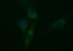 TUBB2A Antibody in Immunocytochemistry (ICC/IF)