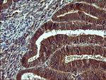 TUBB2A Antibody in Immunohistochemistry (Paraffin) (IHC (P))