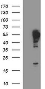TUBB2A Antibody in Western Blot (WB)