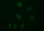 TUBB2B Antibody in Immunocytochemistry (ICC/IF)