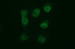 TUBB2B Antibody in Immunocytochemistry (ICC/IF)