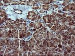 TUBB2B Antibody in Immunohistochemistry (Paraffin) (IHC (P))