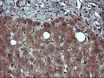 TUBB2B Antibody in Immunohistochemistry (Paraffin) (IHC (P))