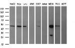 TUBB2B Antibody in Western Blot (WB)