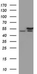 TUBB2B Antibody in Western Blot (WB)