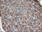TUBB4 Antibody in Immunohistochemistry (Paraffin) (IHC (P))