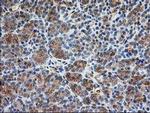 TUBB4 Antibody in Immunohistochemistry (Paraffin) (IHC (P))