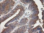 TUBB4 Antibody in Immunohistochemistry (Paraffin) (IHC (P))